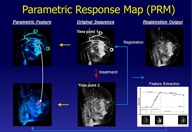 CBIG - Parametric Response Map Graphic